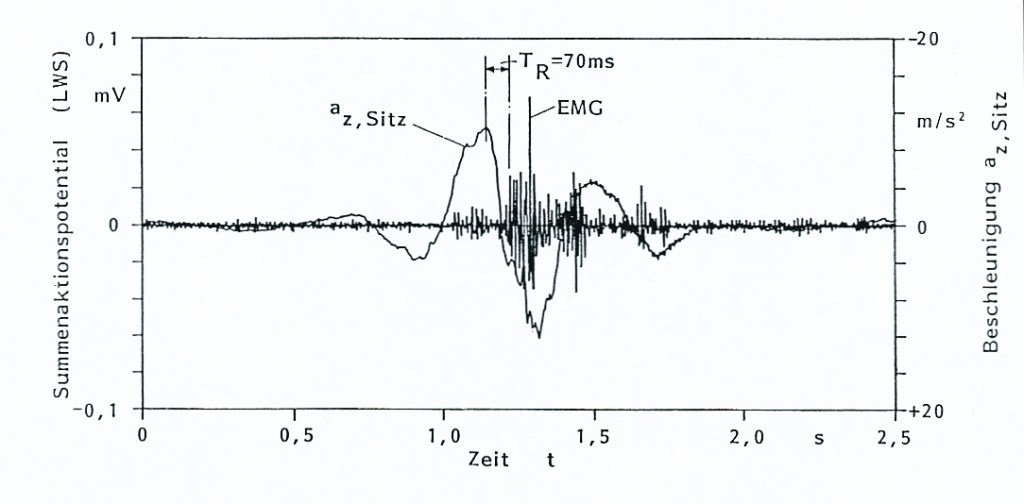 Body reaction in response to a vertical shock caused by driving over a pothole. Acceleration at seat compared to muscle activity (Electromyogram EMG) at lumbar spine. Michael Haverkamp, 1990.